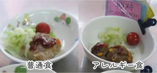 給食の普通色とアレルギー食の画像